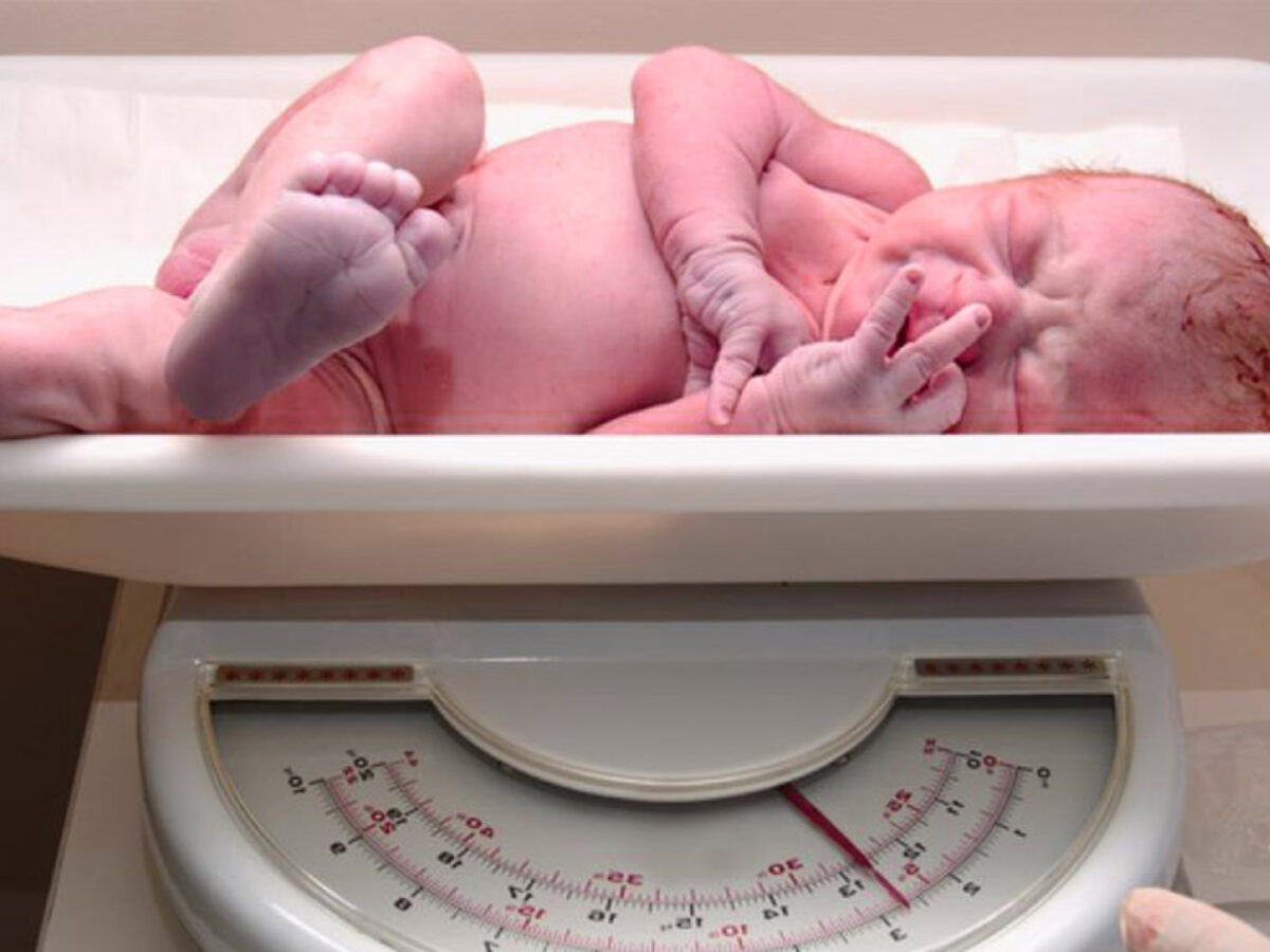 difetti alla nascita del pene