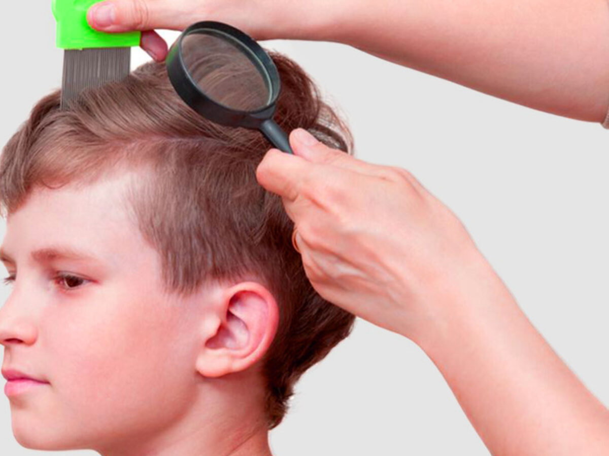Pediculosi Nel Bambino Mamma Sto Bene