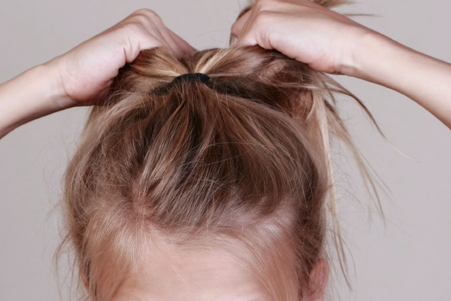 tricotillomania capelli bambina