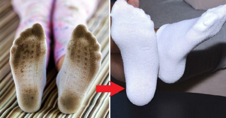 Candeggiare i calzini sporchi