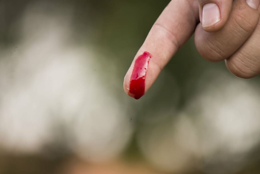 Come togliere le macchie di sangue con acqua ghiacciata