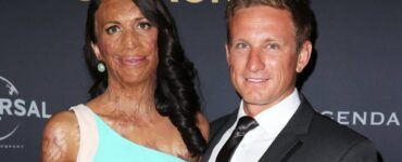 Storia di Turia Pitt