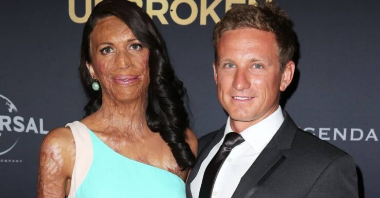 Storia di Turia Pitt