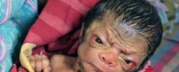 nuovo Benjamin Button Bangladesh