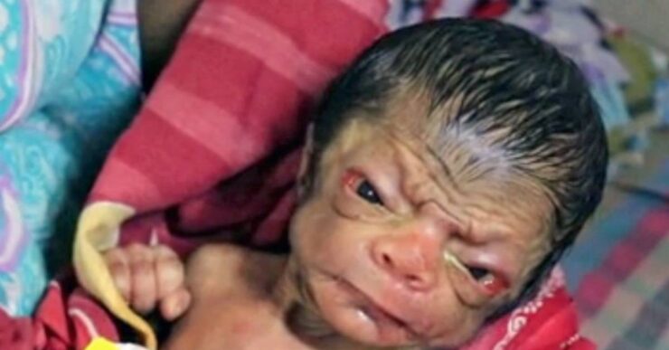 nuovo Benjamin Button Bangladesh