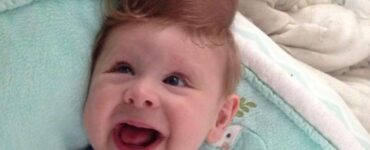 Bambino con cervello fuori