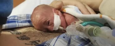 neonato prematuro