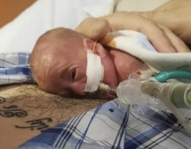 neonato prematuro