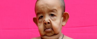 Benjamin Button Bangladesh