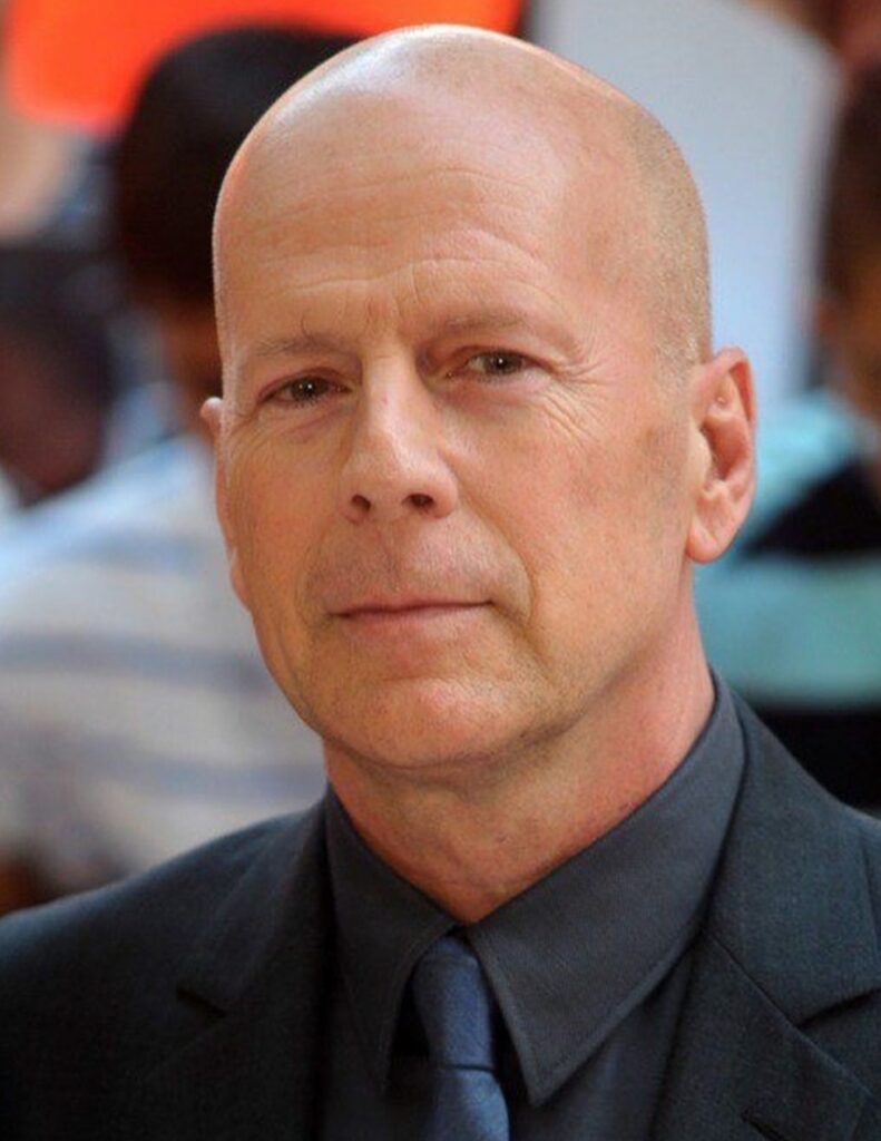 Bruce Willis è affetto da afasia