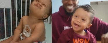 Bimbo di 3 anni con Sindrome di Down combatte con coraggio contro la leucemia