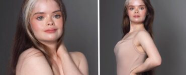 Jessica, la modella con Sindrome di Down