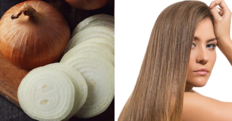 Benefici del succo di cipolla per capelli