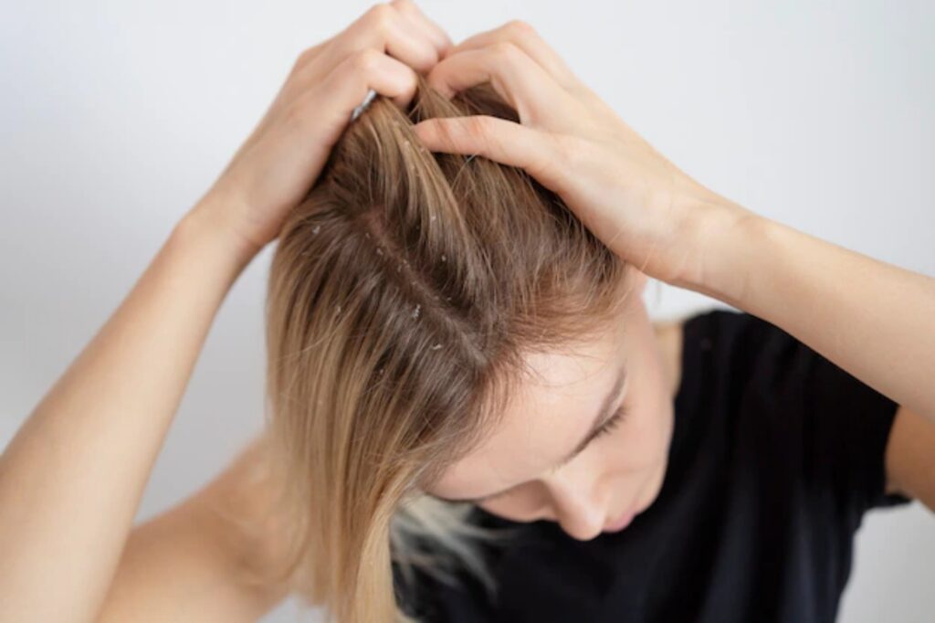 Benefici del succo di cipolla per capelli