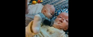 Infermiera adotta i gemelli nati con deformità genetiche