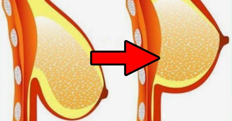 Solleva il seno cadente con questi esercizi