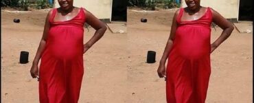 Donna pensava di essere incinta, invece aveva un verme gigante
