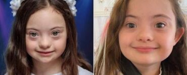 Bimba con sindrome di Down conquista il mondo della moda