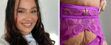 Modelle con smagliature mostrano il vero corpo femminile