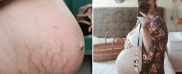 Mamma pubblica poche ore dopo il parto le foto del suo corpo