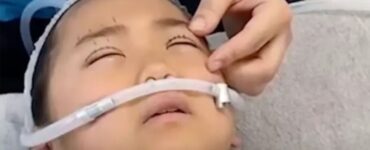 Bambina di 9 anni si sottopone a un intervento di chirurgia estetica