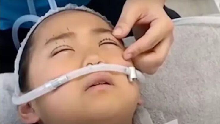 Bambina di 9 anni si sottopone a un intervento di chirurgia estetica