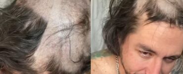 Papà si addormenta e i figli gli tagliano i capelli