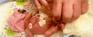 Bambina prematura sopravvive contro ogni aspettativa dei medici